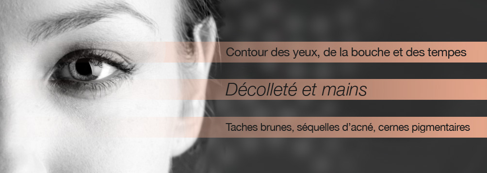Esthetique à nice - traitement des rides - resurfacing - peeling - mésotherapie